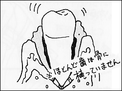 ～歯周病になってしまった歯ぐき～